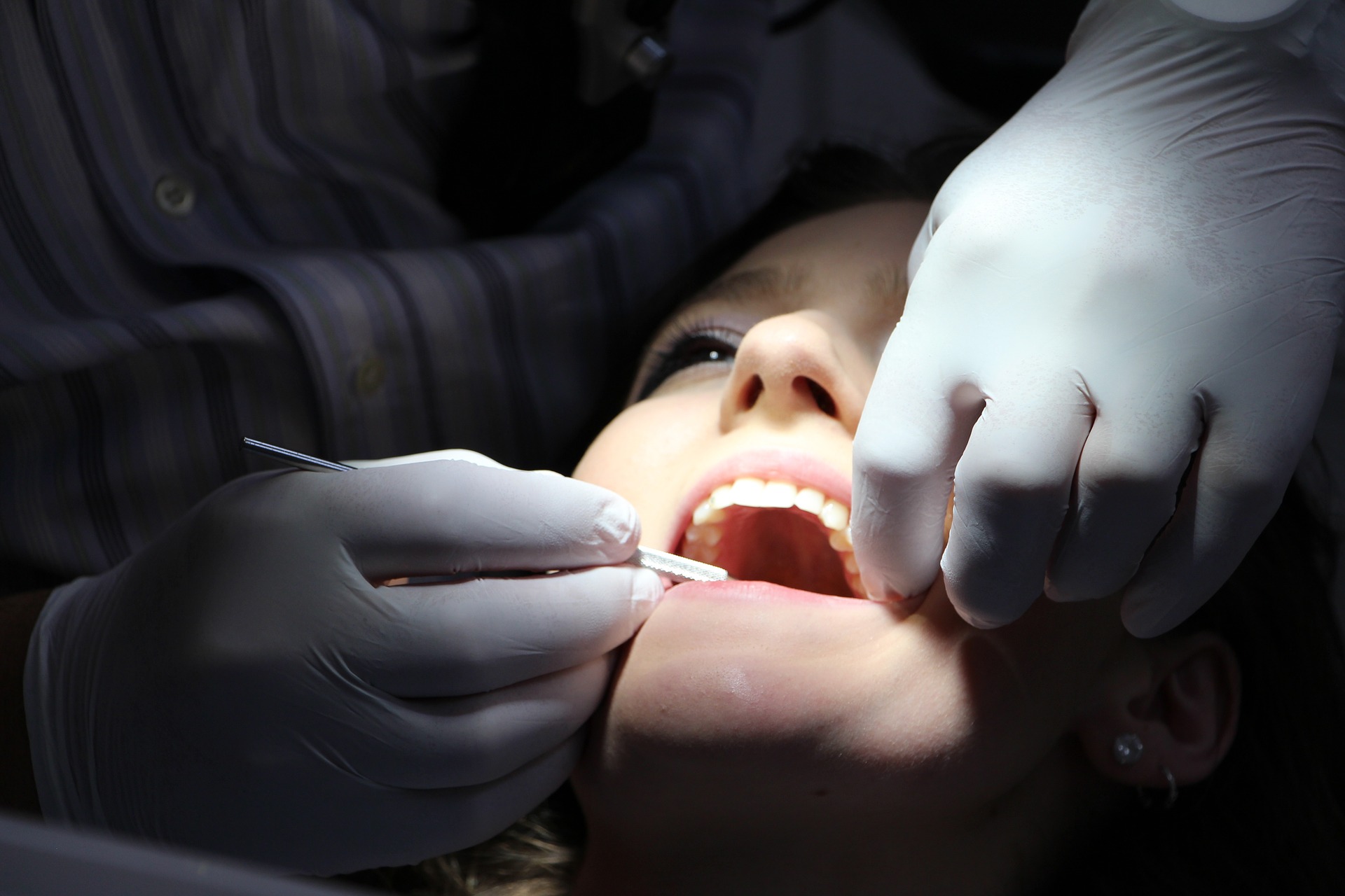 What is A Root Canal?