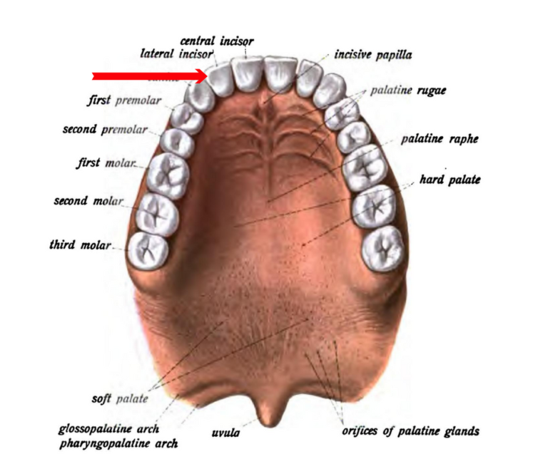 Incisor