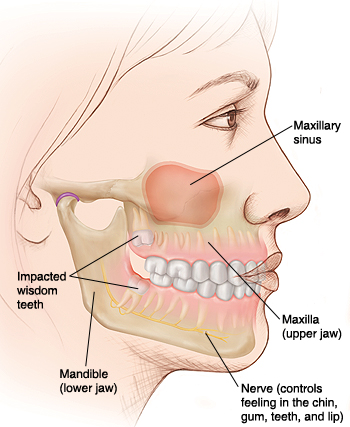 What are wisdom teeth? Michael Sinkin DDS