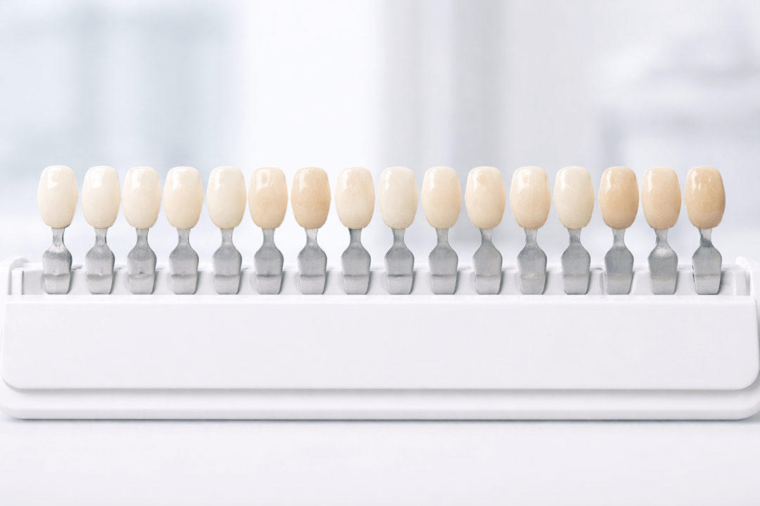 Dental shade guide displaying a range of tooth colors from light to dark