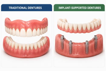 Side-by-side illustration comparing traditional dentures with implant-supported dentures secured by dental implants.